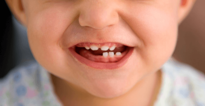 Children's Dentistry
