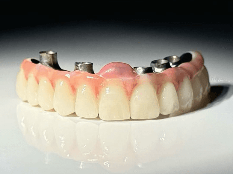 Orthodontics & Implants